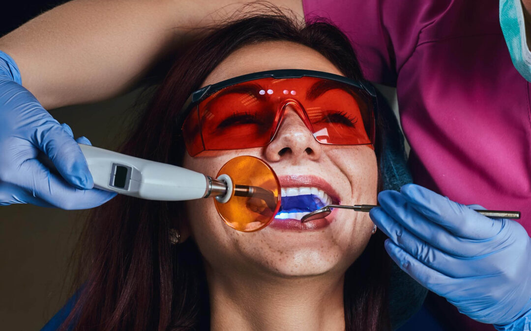 DIY Teeth Whitening: Safe or Risky?