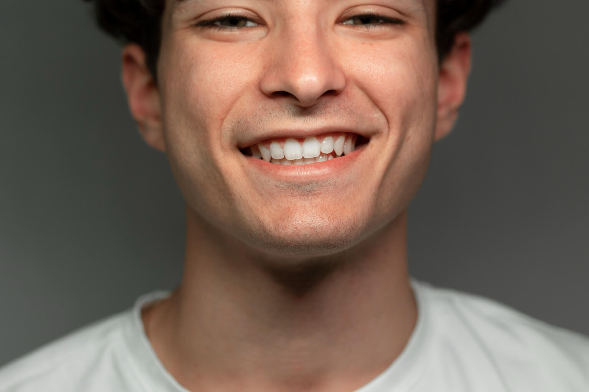 $variable({"type":"content","value":{"name":"site_title","settings":{"before":"Achieve your best smile at ","after":""}}})$