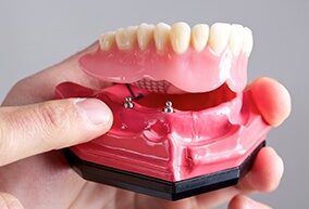 Denture process consultation