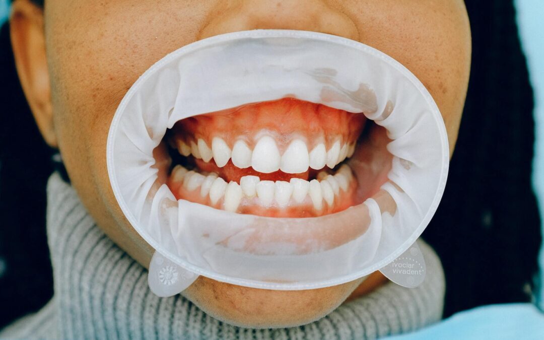 Gum Disease Symptoms: When it Comes to Staying Healthy, These are the Red Flags