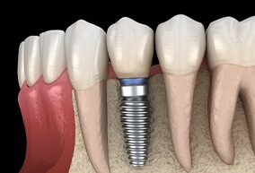 Anthem Dentistry Logo