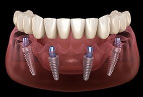 Anthem Dentistry Logo