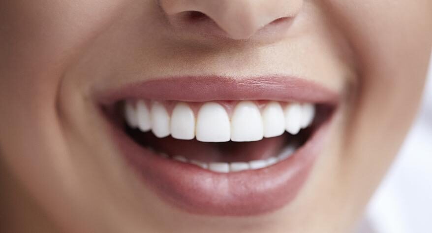 Dental Sealants and Fluoride Treatment